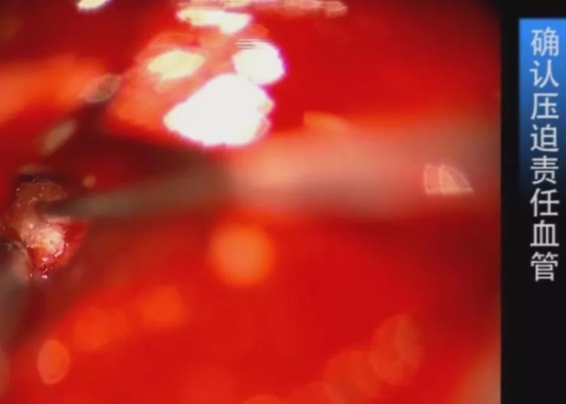 51暗网猎奇在线观看免费 暗网内容常涉及法律灰色地带